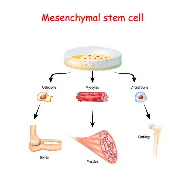 Illustration of mesenchymal stem cell therapy