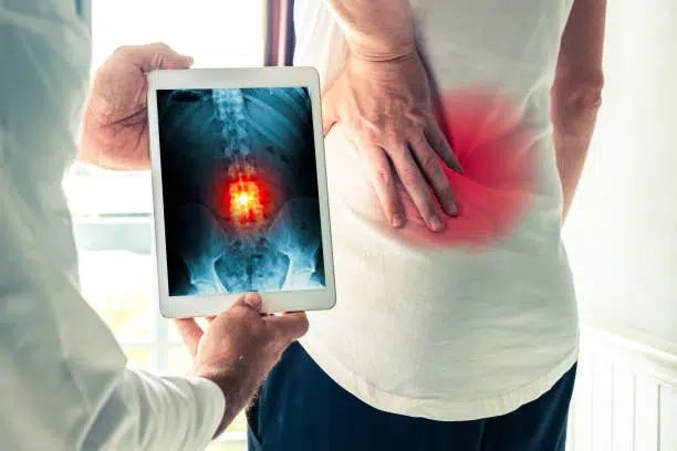 Doctor is checking the x-ray of the patients lower back in a tablet