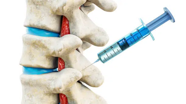 Facet joint injection, therapy against backbone injury or pain