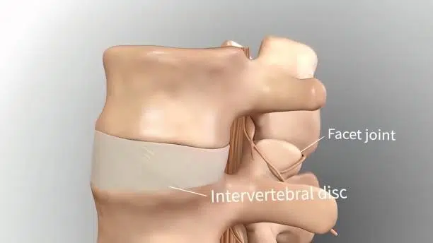 Medical illustration of spinal cord showing where the facet joint and intervertebral disc is